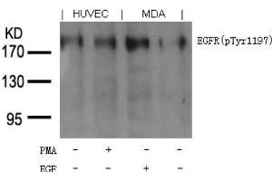 Image no. 1 for anti-Epidermal Growth Factor Receptor (EGFR) (pTyr1197) antibody (ABIN401613) (EGFR Antikörper  (pTyr1197))