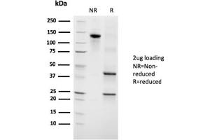 SDS-PAGE Analysis Purified Growth Hormone Mouse Monoclonal Antibody (GH/3155). (Growth Hormone 1 Antikörper)
