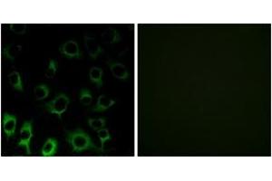 Immunofluorescence analysis of HuvEc cells, using RPS4X Antibody.