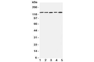 Western blot testing of Integrin alpha 7 antibody and Lane 1:  293T