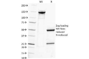 SDS-PAGE Analysis Purified IgG Monoclonal Antibody (IG217). (IGHG Antikörper)