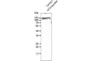Western Blotting (WB) image for anti-mTurquoise Fluorescent Protein antibody (ABIN7273076) (mTurquoise Fluorescent Protein Antikörper)