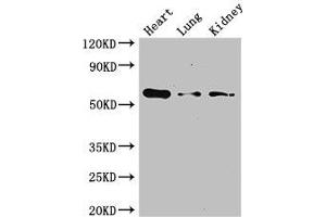 Western Blot Positive WB detected in: Mouse heart tissue, Mouse lung tissue, Mouse kidney tissue All lanes: Gcgr antibody at 3 μg/mL Secondary Goat polyclonal to rabbit IgG at 1/50000 dilution Predicted band size: 55 kDa Observed band size: 55 kDa (Glucagon Receptor Antikörper  (AA 26-136))