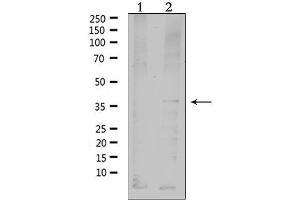 Western blot analysis of extracts from HepG2, using MC4R Antibody.