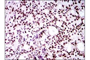 Western Blotting (WB) image for anti-Twist Homolog 1 (Drosophila) (TWIST1) (AA 9-74) antibody (ABIN1842915)