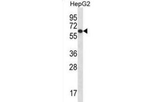 Western Blotting (WB) image for anti-TBC1 Domain Family, Member 22A (TBC1D22A) antibody (ABIN2996989) (TBC1D22A Antikörper)