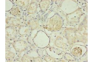 Immunohistochemistry of paraffin-embedded human kidney tissue using ABIN7142054 at dilution of 1:100 (PLCD4 Antikörper  (AA 1-762))