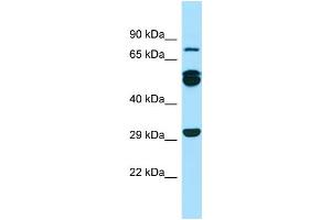 Western Blotting (WB) image for anti-Rab11 Family-Interacting Protein 1 (RAB11FIP1) (N-Term) antibody (ABIN2790054)