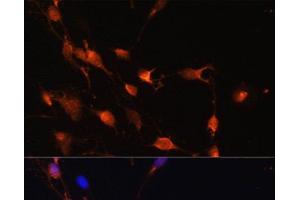 Immunofluorescence analysis of C6 cells using RAB11A Polyclonal Antibody at dilution of 1:100. (RAB11A Antikörper)