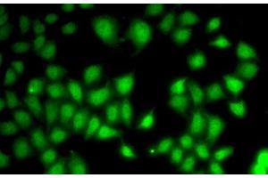 Immunofluorescence analysis of A-549 cells using WNT7A Polyclonal Antibody
