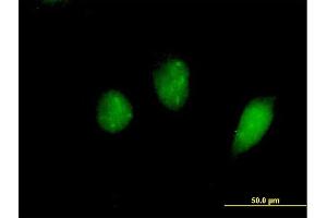 Immunofluorescence of purified MaxPab antibody to FKHL18 on HeLa cell.