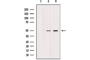 Western Blotting (WB) image for anti-5-Hydroxytryptamine (serotonin) Receptor 3 Family Member D (HTR3D) antibody (ABIN6262420)
