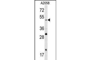 Western blot analysis of SOX4 antibody (N-term) (ABIN388786 and ABIN2839119) in  cell line lysates (35 μg/lane). (SOX4 Antikörper  (N-Term))