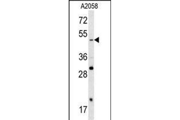 SOX4 Antikörper  (N-Term)