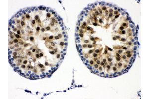 Anti- Cdk2 Picoband antibody,IHC(P) IHC(P): Mouse Testis Tissue (CDK2 Antikörper  (AA 81-298))