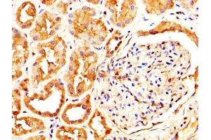 IHC image of ABIN7146077 diluted at 1:600 and staining in paraffin-embedded human kidney tissue performed on a Leica BondTM system. (CLEC4E Antikörper  (AA 41-219))