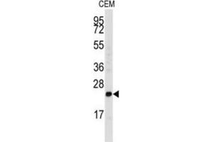 Western Blotting (WB) image for anti-Fibroblast Growth Factor 4 (FGF4) antibody (ABIN3003719) (FGF4 Antikörper)