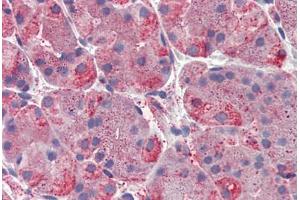 Human, Stomach: Formalin-Fixed Paraffin-Embedded (FFPE) (ERP44 Antikörper  (C-Term))
