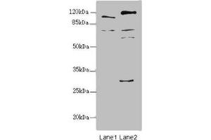 Western blot All lanes: TM9SF1 antibody at 2. (TM9SF1 Antikörper  (AA 28-230))