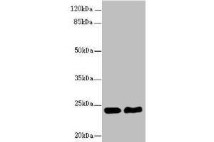 Western blot All lanes: RAB5B antibody at 5. (RAB5B Antikörper  (AA 1-215))