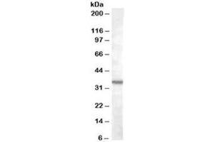 Western blot testing of K562 lysate with BDKRB1 antibody at 2ug/ml. (BDKRB1 Antikörper)