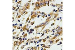 Immunohistochemical analysis of EIF3A staining in human stomach formalin fixed paraffin embedded tissue section. (EIF3A Antikörper)