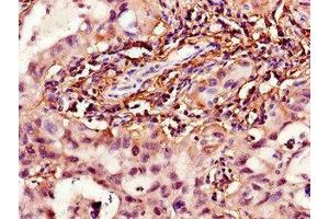 Immunohistochemistry (IHC) image for anti-Hydroxyprostaglandin Dehydrogenase 15-(NAD) (HPGD) (AA 14-130) antibody (ABIN7142110)
