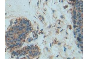 DAB staining on IHC-P; Samples: Human Mammary gland Tissue (PDGF-BB Homodimer (AA 82-190) Antikörper)