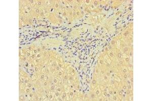 Immunohistochemistry of paraffin-embedded human liver tissue using ABIN7170681 at dilution of 1:100 (SRPK3 Antikörper  (AA 1-300))