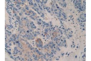 Immunohistochemistry (IHC) image for anti-Dipeptidyl-Peptidase 4 (DPP4) (AA 484-728) antibody (ABIN7432829)