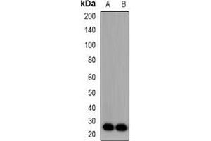 Western blot analysis of FGF11 expression in Hela (A), NIH3T3 (B) whole cell lysates. (FGF11 Antikörper)