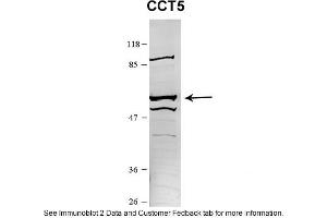 Sample Type: HEK 293 (10ug)Primary Dilution: 1:1000Secondary Antibody: conjugated goat anti-rabbitSecondary Dilution: 1:10,000Image Submitted By: Amy GrayBrigham Young University (CCT5 Antikörper  (N-Term))