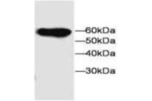 Image no. 1 for anti-Microfibrillar-Associated Protein 3-Like (MFAP3L) antibody (ABIN791551) (MFAP3L Antikörper)