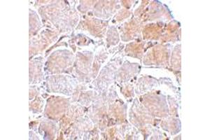 Immunohistochemistry of MAPKAP1 in human skeletal muscle tissue with MAPKAP1 polyclonal antibody  at 2.