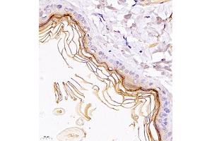 Immunohistochemistry of paraffin embedded rat skin using TR2IT1 (ABIN7075887) at dilution of 1:1500 (400x lens) (TXNRD3NB Antikörper)