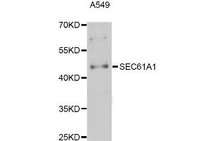 Western blot analysis of extracts of A-549 cells, using SEC61A1 Antibody (ABIN5998768) at 1:3000 dilution. (SEC61A1 Antikörper)