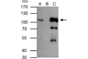 IP Image B-Raf antibody [N2C1], Internal immunoprecipitates B-Raf protein in IP experiments. (SNRPE Antikörper  (Internal Region))