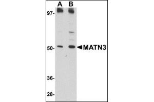 Western blot analysis of MATN3 in 3T3 cell lysate with this product at (A) 1 and (B) 2 μg/ml. (Matrilin 3 Antikörper  (C-Term))
