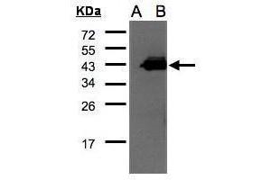 WB Image Western Blot analysis of CCNDBP1 expression in transfected 293T cell line by CCNDBP1 polyclonal antibody. (CCNDBP1 Antikörper  (C-Term))