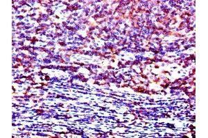 Immunohistochemistry (IHC) image for anti-Lymphocyte-Specific Protein tyrosine Kinase (LCK) (AA 1-539) antibody (ABIN7174038)