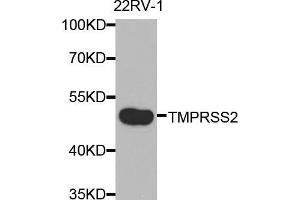 Western blot analysis of extracts of 22Rv1 cells, using TMPRSS2 antibody (ABIN5975349) at 1/2000 dilution. (TMPRSS2 Antikörper)