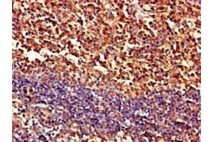 Immunohistochemistry of paraffin-embedded human tonsil tissue using ABIN7162982 at dilution of 1:100 (PIPOX Antikörper  (AA 259-337))