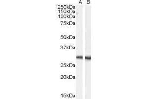 Western Blotting (WB) image for Doublecortin Domain Containing 2 (DCDC2) peptide (ABIN369575) (Doublecortin Domain Containing 2 (DCDC2) Peptid)