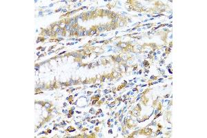 Immunohistochemistry of paraffin-embedded human stomach using HLA-DPB1 antibody at dilution of 1:100 (40x lens). (HLA-DPB1 Antikörper)