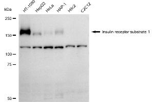 Western blotting analysis using Insulin receptor substrate 1 antibody (ABIN7799046).