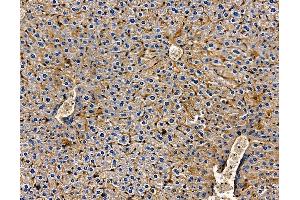 ABIN7094970 and ABIN7099026 at 1/100 staining mouse liver tissue by IHC-P.