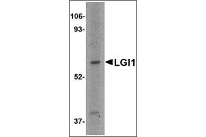 Western blot analysis of LGI1 in HeLa cell lysate with this product at 2 μg/ml.