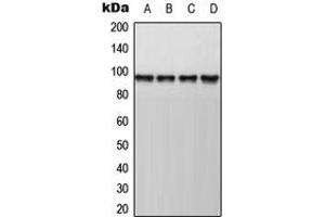 Western blot analysis of AKAP8 expression in HepG2 (A), Jurkat (B), mouse kidney (C), rat kidney (D) whole cell lysates. (AKAP8 Antikörper  (Center))