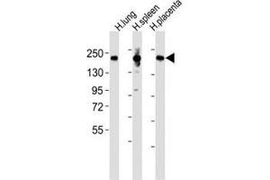 Western blot testing of MRC1L1 antibody at 1:2000 dilution and human samples: Lane 1: lung lysate; 2: spleen lysate; 3: placenta lysate; Predicted band size : 166 kDa. (Macrophage Mannose Receptor 1 Antikörper  (AA 359-388))