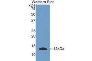 Western blot analysis of the recombinant protein. (PLAUR Antikörper  (AA 123-216))